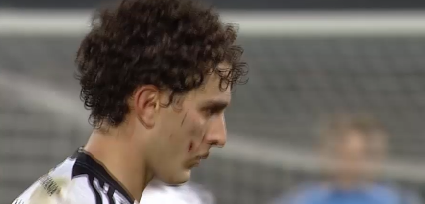 Omar El Sawy a fost desfigurat: "Arată ca după o bătaie în parc"